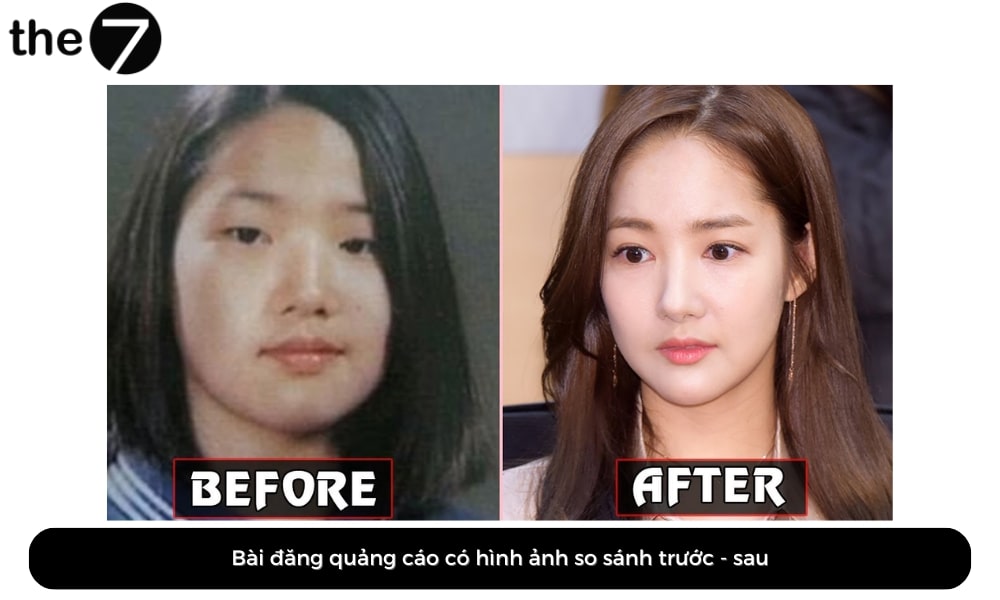 Vi phạm chính sách quảng cáo Facebook vì có hình ảnh so sánh trước – sau